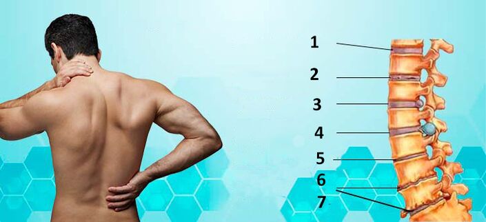 Στάδια ανάπτυξης της οστεοχονδρωσίας